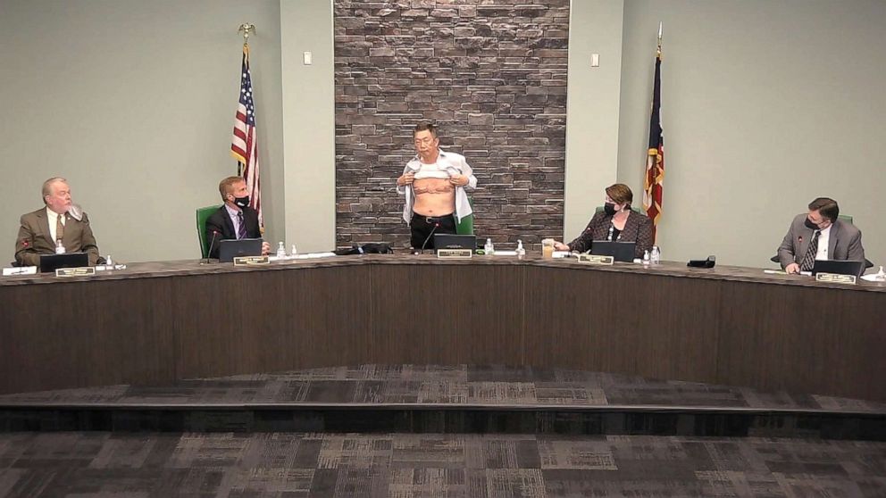 PHOTO: Lee Wong, a township trustee in West Chester, Ohio, lifts his shirt to show scars from his military service, March 23, 2021, in response to those who question his patriotism.